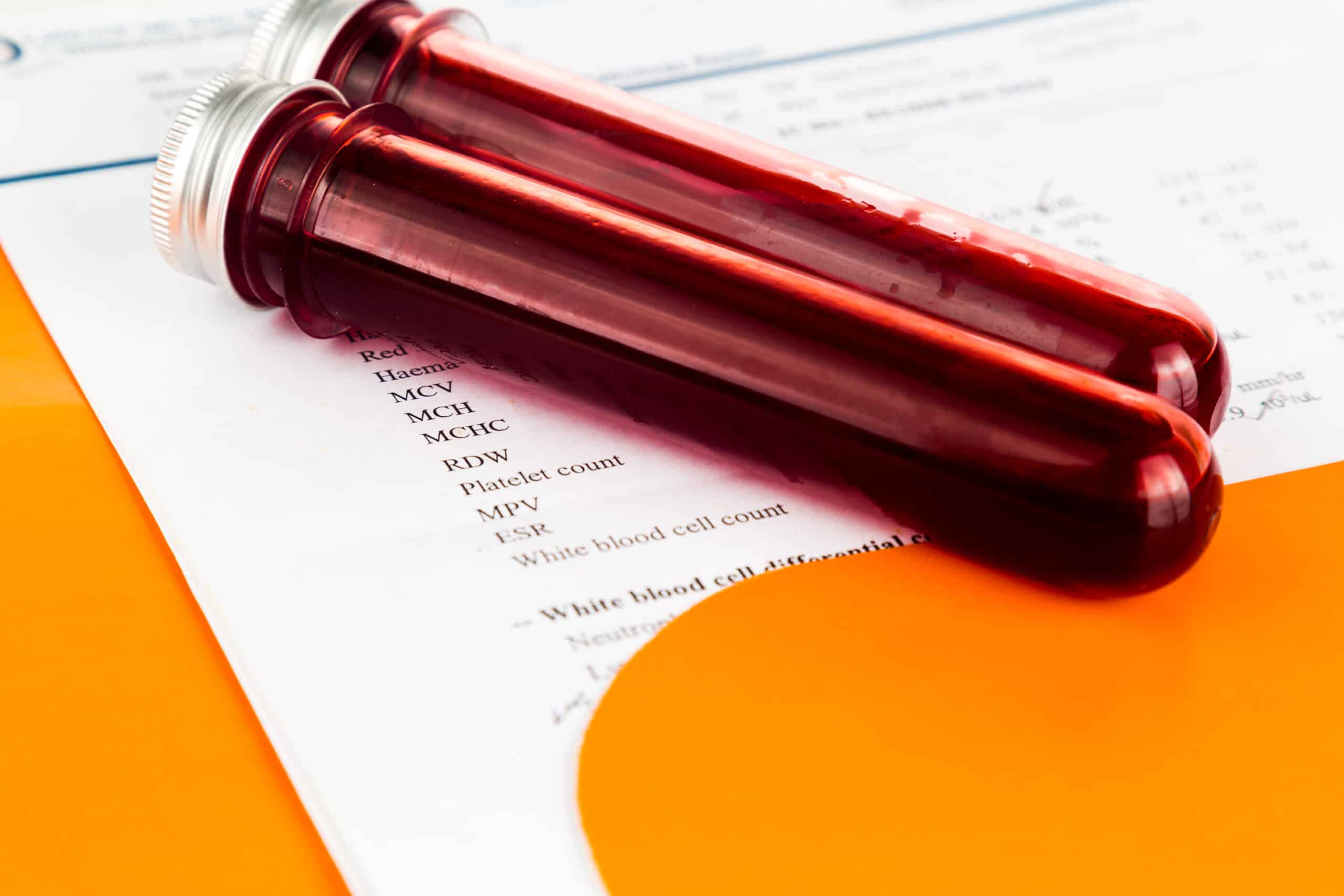 Résultats de biomonitoring PFAS : un aperçu compliqué
